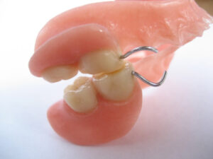 Protesi dental removible