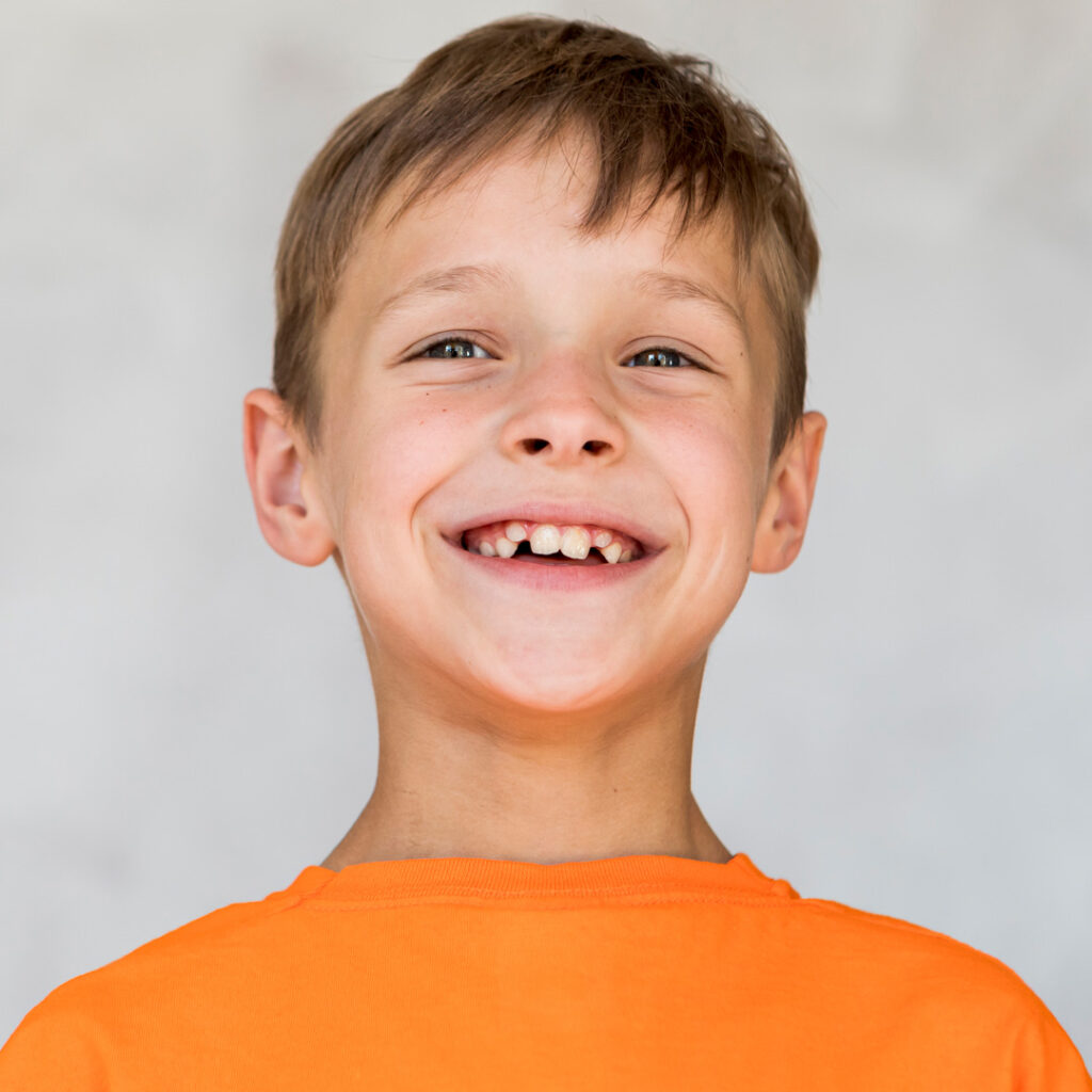 Maloclusió dental en nens