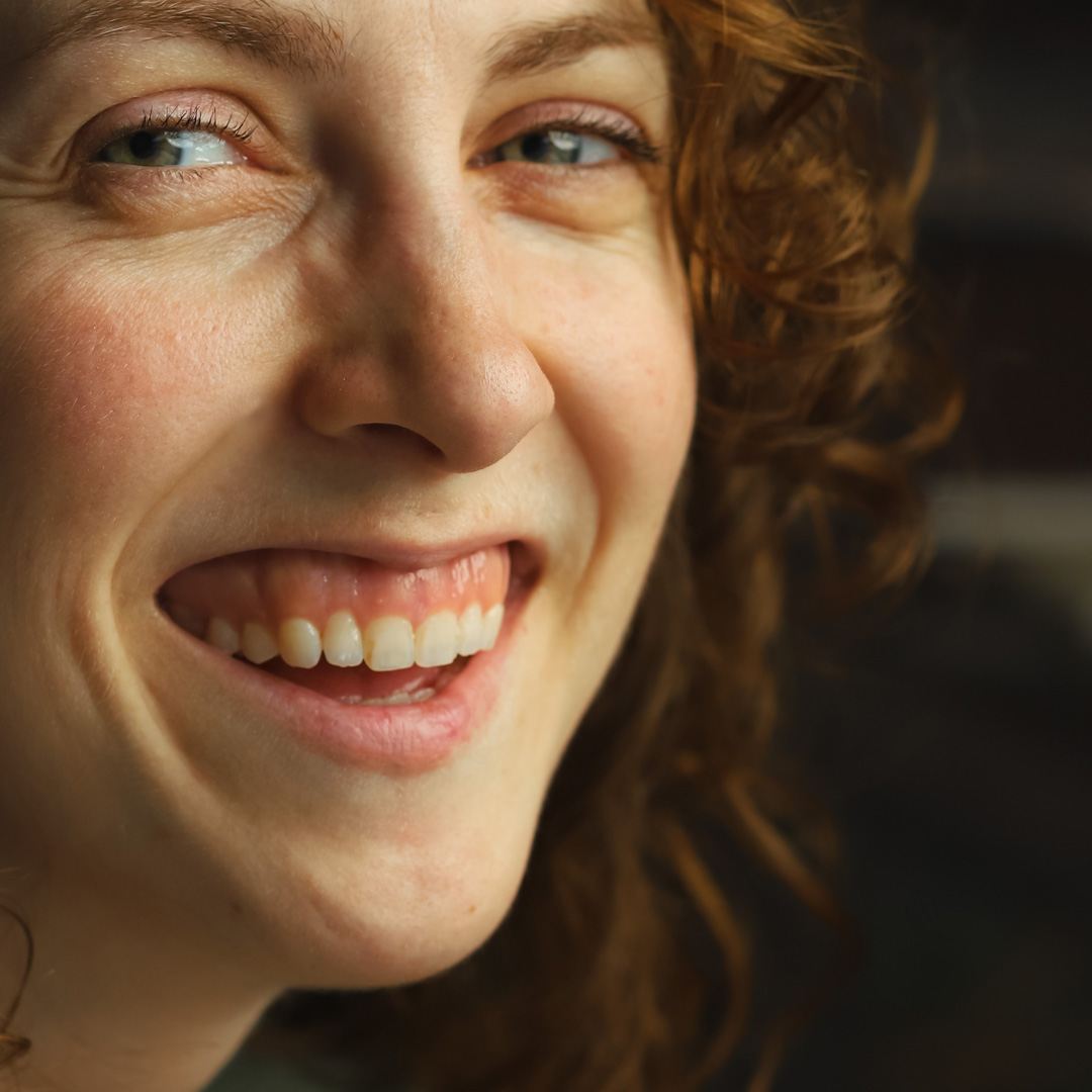 Correcció del somriure gingival